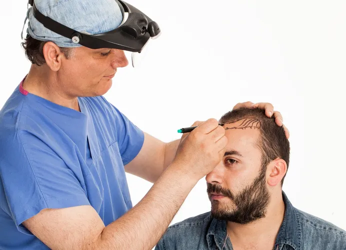 Hair Transplant