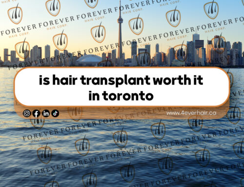 is hair transplant worth it  in toronto