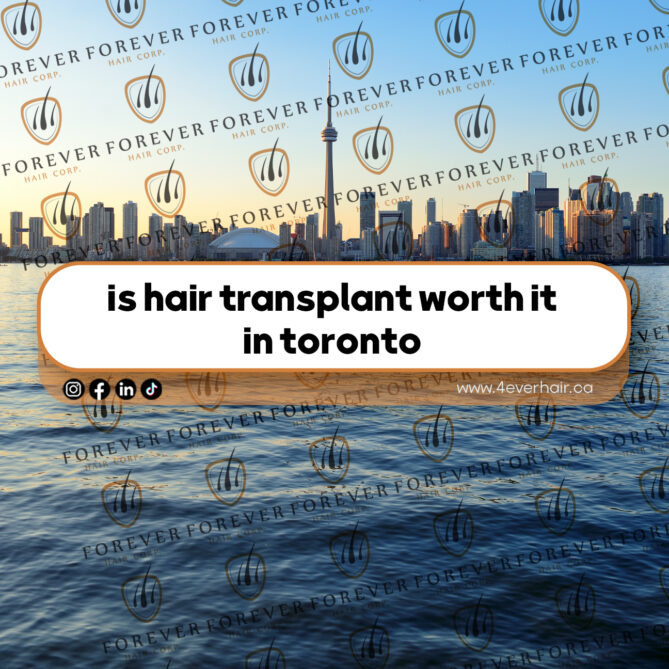 is hair transplant worth it in toronto
